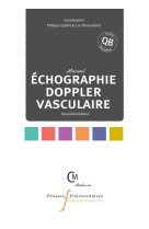 échographie doppler vasculaire